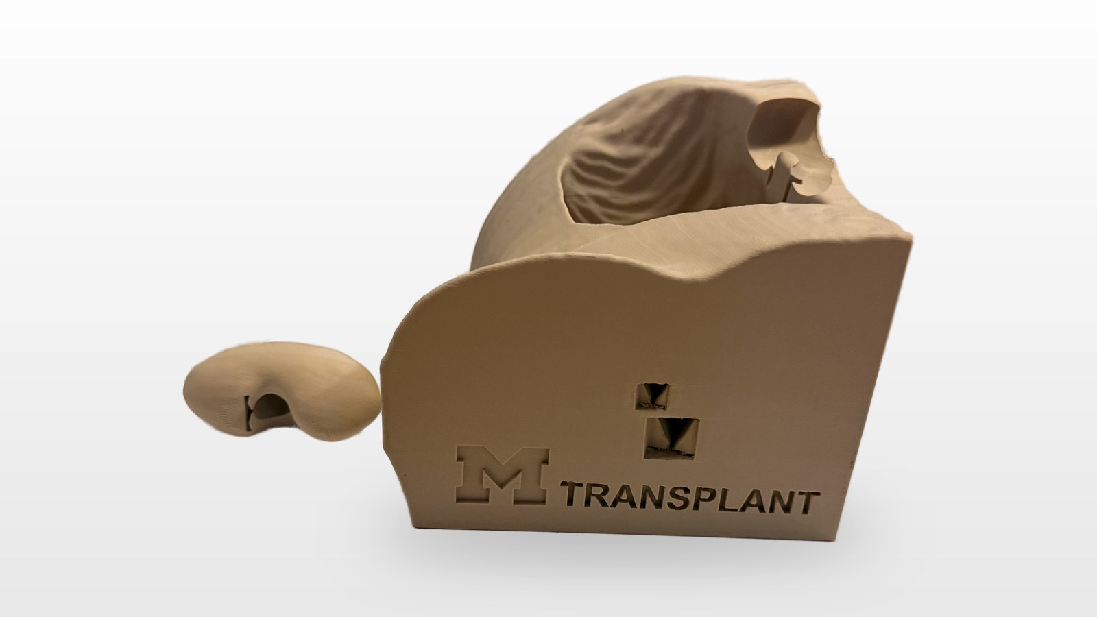 3D-printed kidney transplant surgical training model in tan PLA: a large abdominal cavity block engraved M TRANSPLANT, its sculpted recipient fossa visible, beside a separately printed kidney